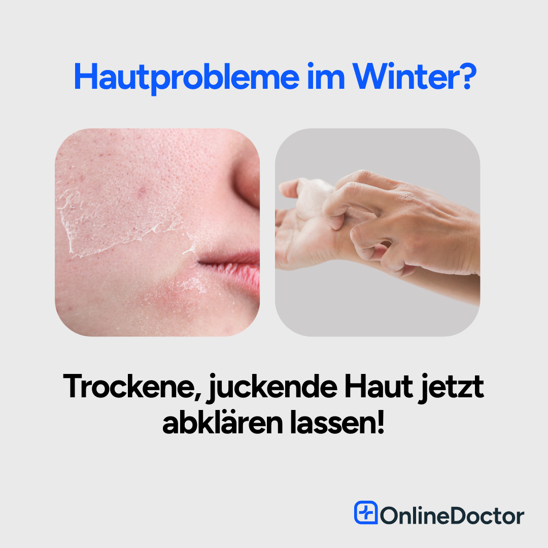 Hautprobleme im Winter